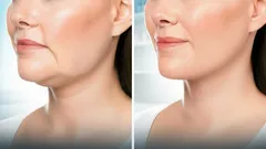 5 jednostavnih vježbi koje vam daju 'podignuto lice' bez posjeta kozmetičarki – za samo nekoliko tjedana